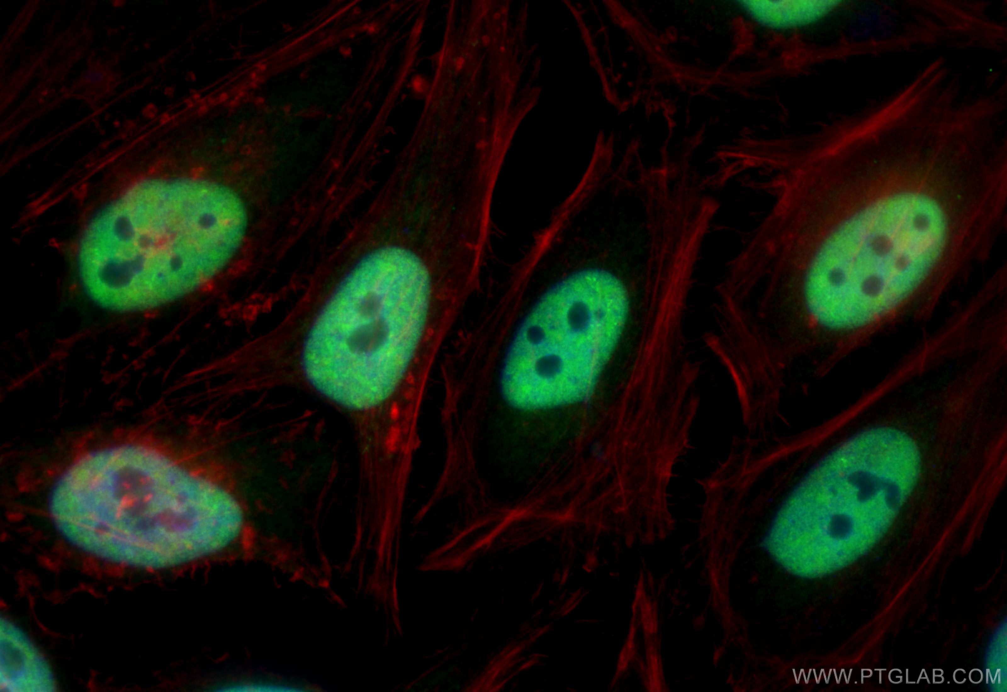 Immunofluorescence (IF) / fluorescent staining of HeLa cells using NUDT21 Polyclonal antibody (10322-1-AP)