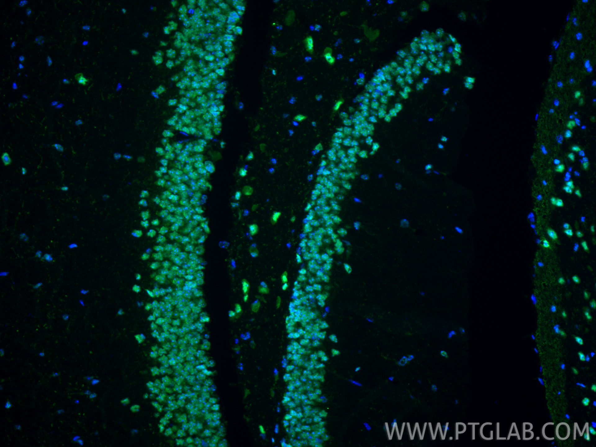 Immunofluorescence (IF) / fluorescent staining of mouse brain tissue using NUDT21 Polyclonal antibody (10322-1-AP)