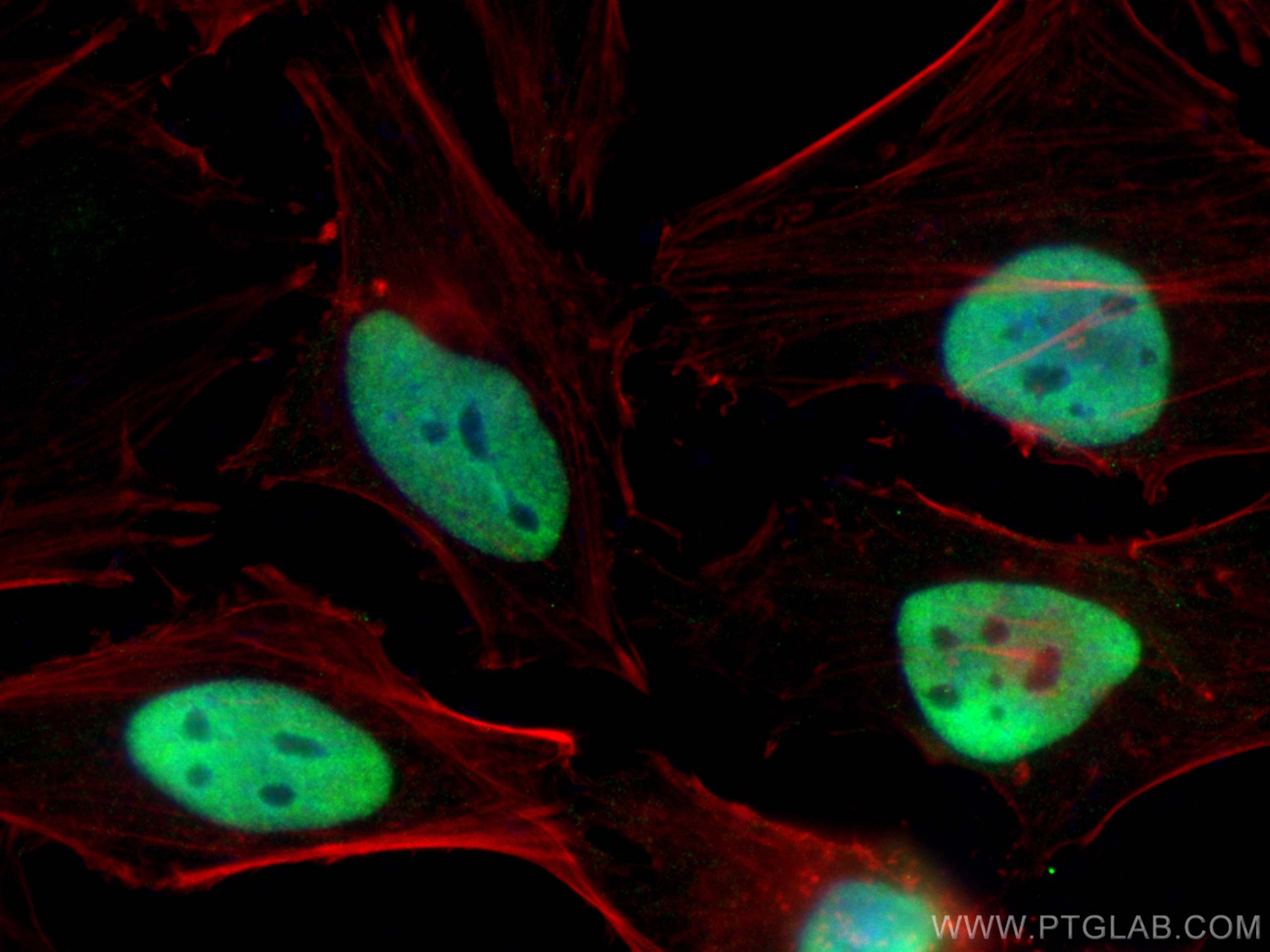 Immunofluorescence (IF) / fluorescent staining of HeLa cells using NUDT21 Monoclonal antibody (66335-1-Ig)