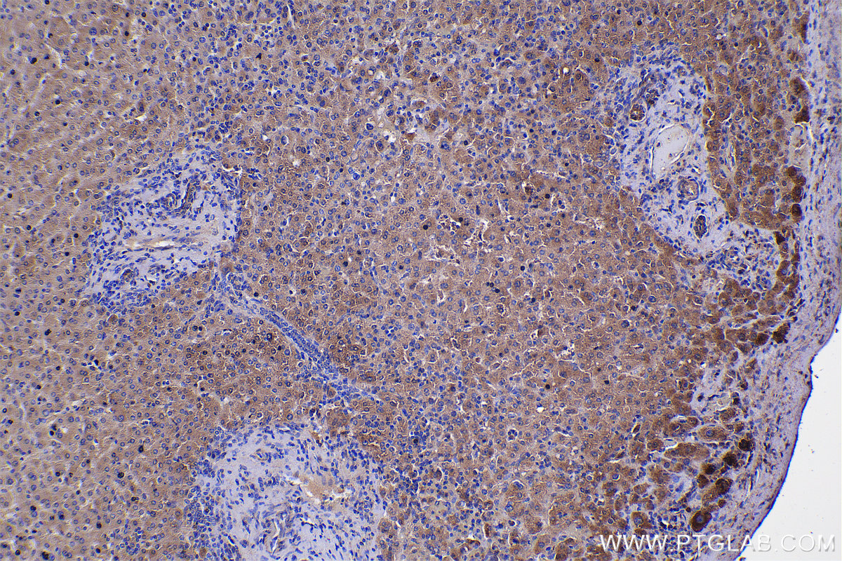 Immunohistochemistry (IHC) staining of human liver tissue using NUDT6 Polyclonal antibody (11181-1-AP)