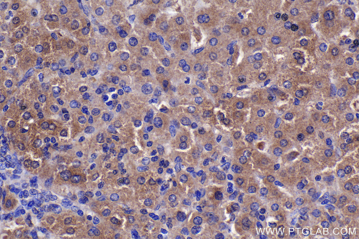 Immunohistochemistry (IHC) staining of human liver tissue using NUDT6 Polyclonal antibody (11181-1-AP)