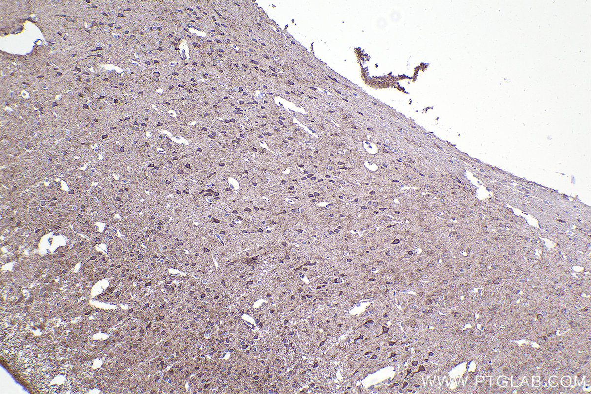 Immunohistochemistry (IHC) staining of mouse brain tissue using NUDT6 Polyclonal antibody (11181-1-AP)