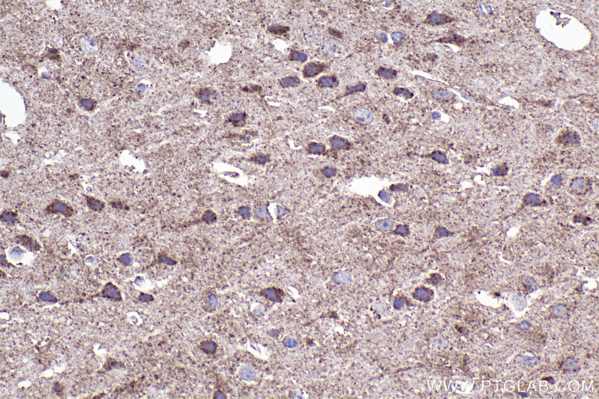 Immunohistochemistry (IHC) staining of mouse brain tissue using NUDT6 Polyclonal antibody (11181-1-AP)