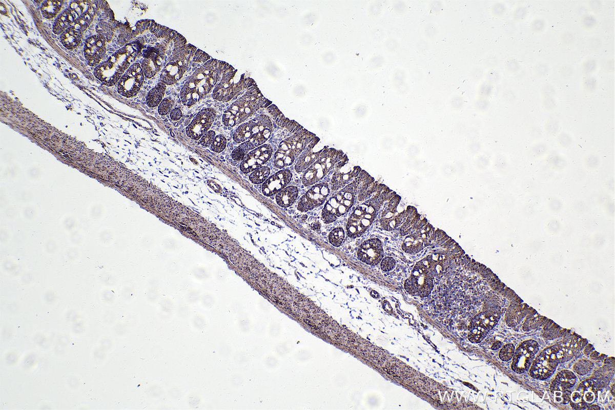 Immunohistochemistry (IHC) staining of rat colon tissue using NUDT6 Polyclonal antibody (11181-1-AP)