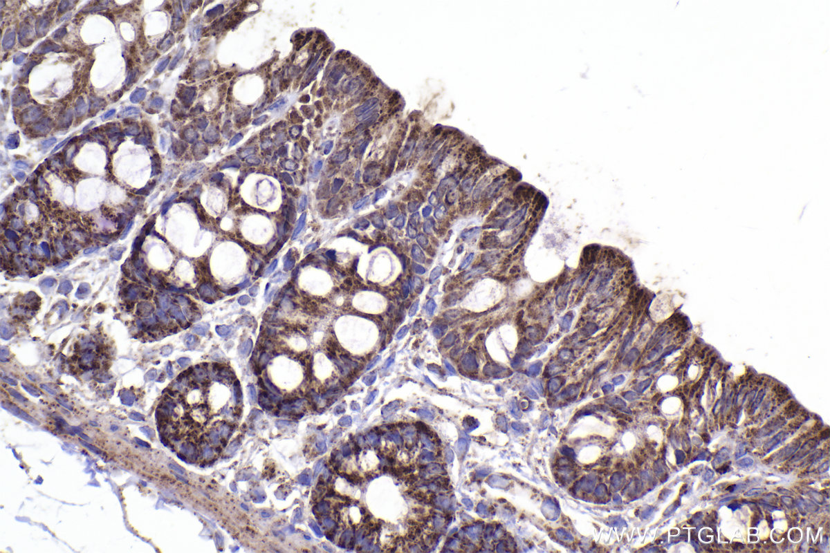 Immunohistochemistry (IHC) staining of rat colon tissue using NUDT6 Polyclonal antibody (11181-1-AP)