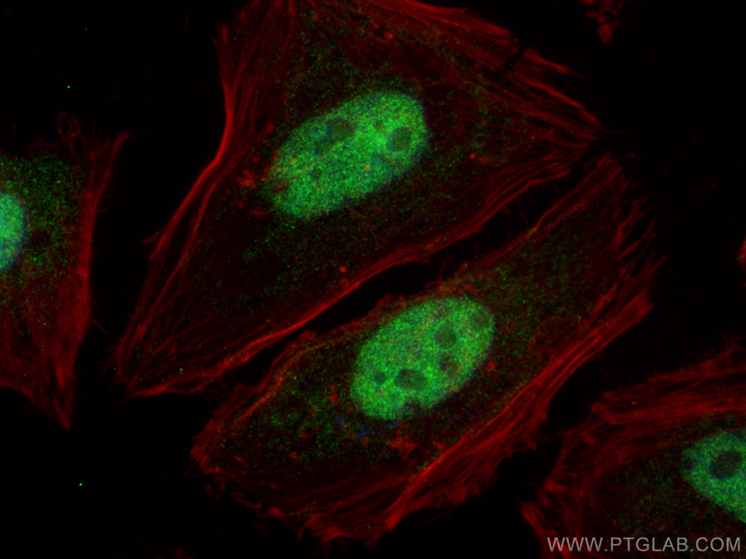 Immunofluorescence (IF) / fluorescent staining of HeLa cells using NUFIP1 Polyclonal antibody (12515-1-AP)