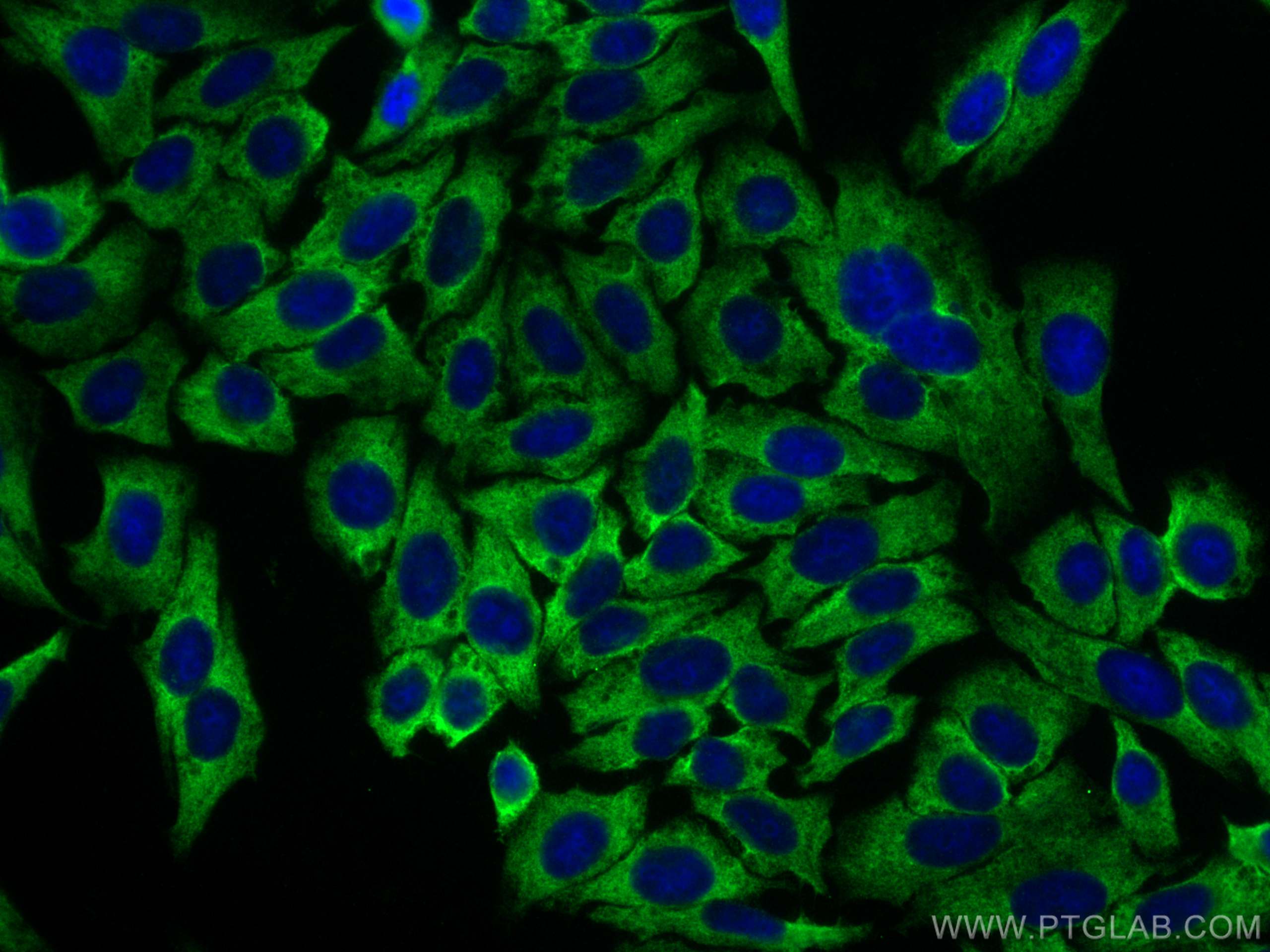 Immunofluorescence (IF) / fluorescent staining of HepG2 cells using NUFIP2 Polyclonal antibody (17752-1-AP)