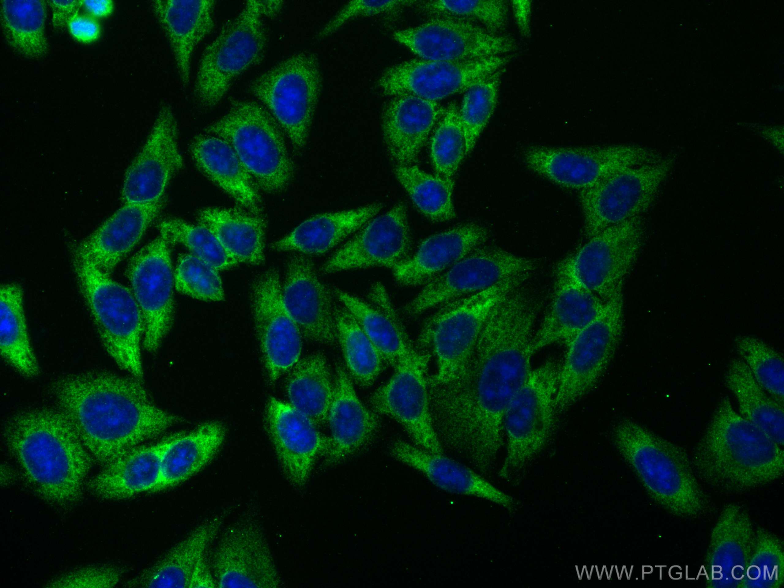 Immunofluorescence (IF) / fluorescent staining of HepG2 cells using NUFIP2 Monoclonal antibody (67195-1-Ig)