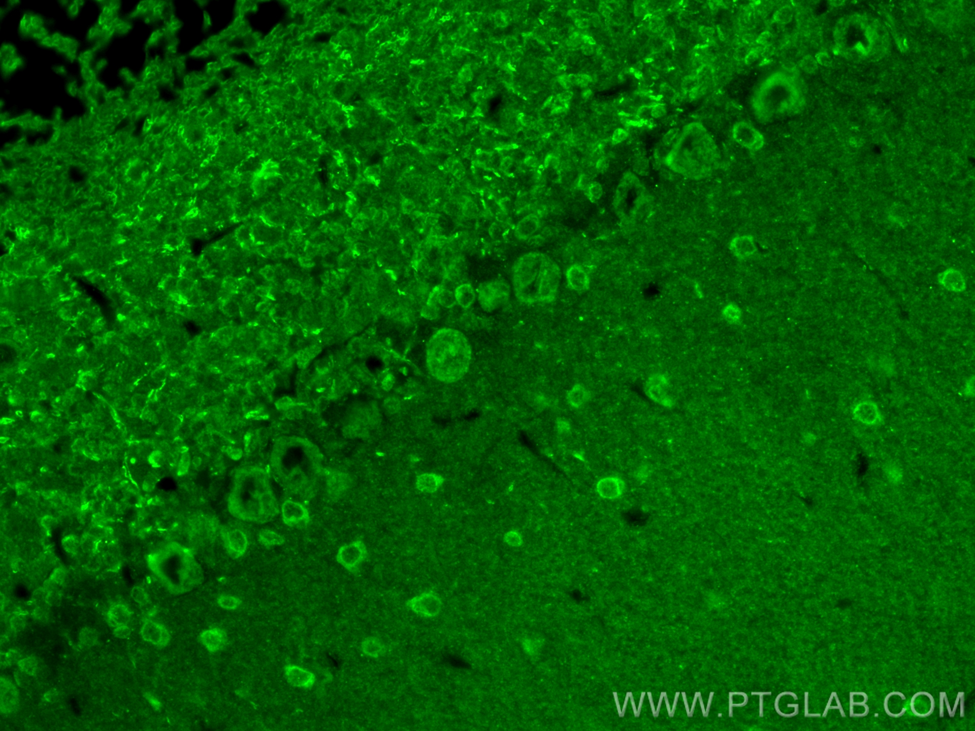 Immunofluorescence (IF) / fluorescent staining of mouse cerebellum tissue using NUMBL Polyclonal antibody (10111-1-AP)