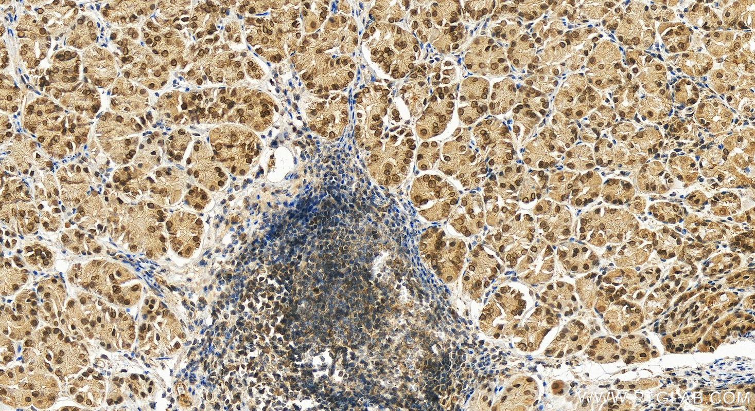 Immunohistochemistry (IHC) staining of human stomach tissue using NUP54 Polyclonal antibody (16232-1-AP)