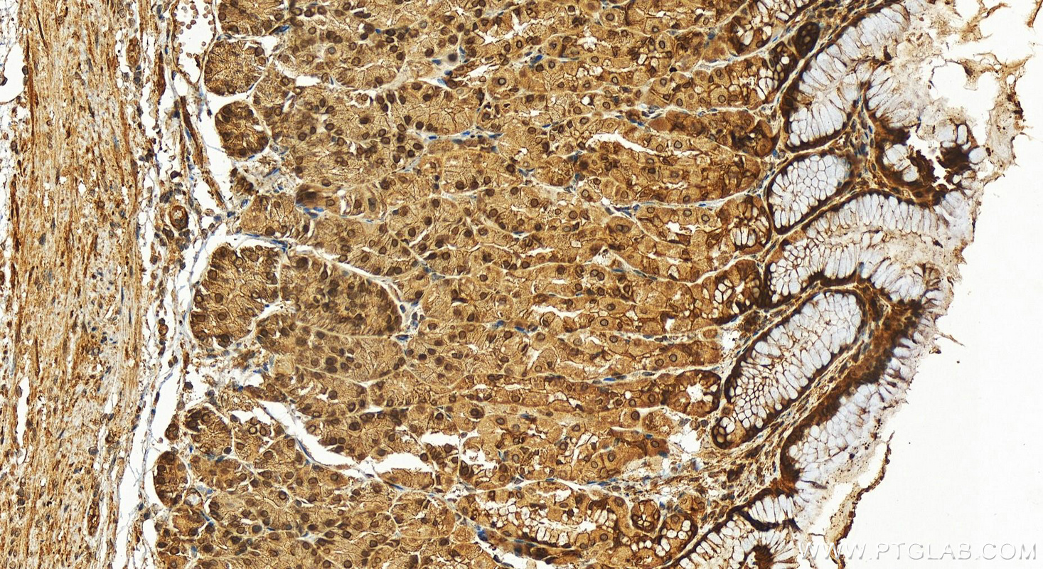 Immunohistochemistry (IHC) staining of human stomach tissue using NUP62 Polyclonal antibody (13916-1-AP)