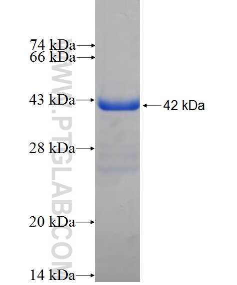 NXT1 fusion protein Ag0116 SDS-PAGE