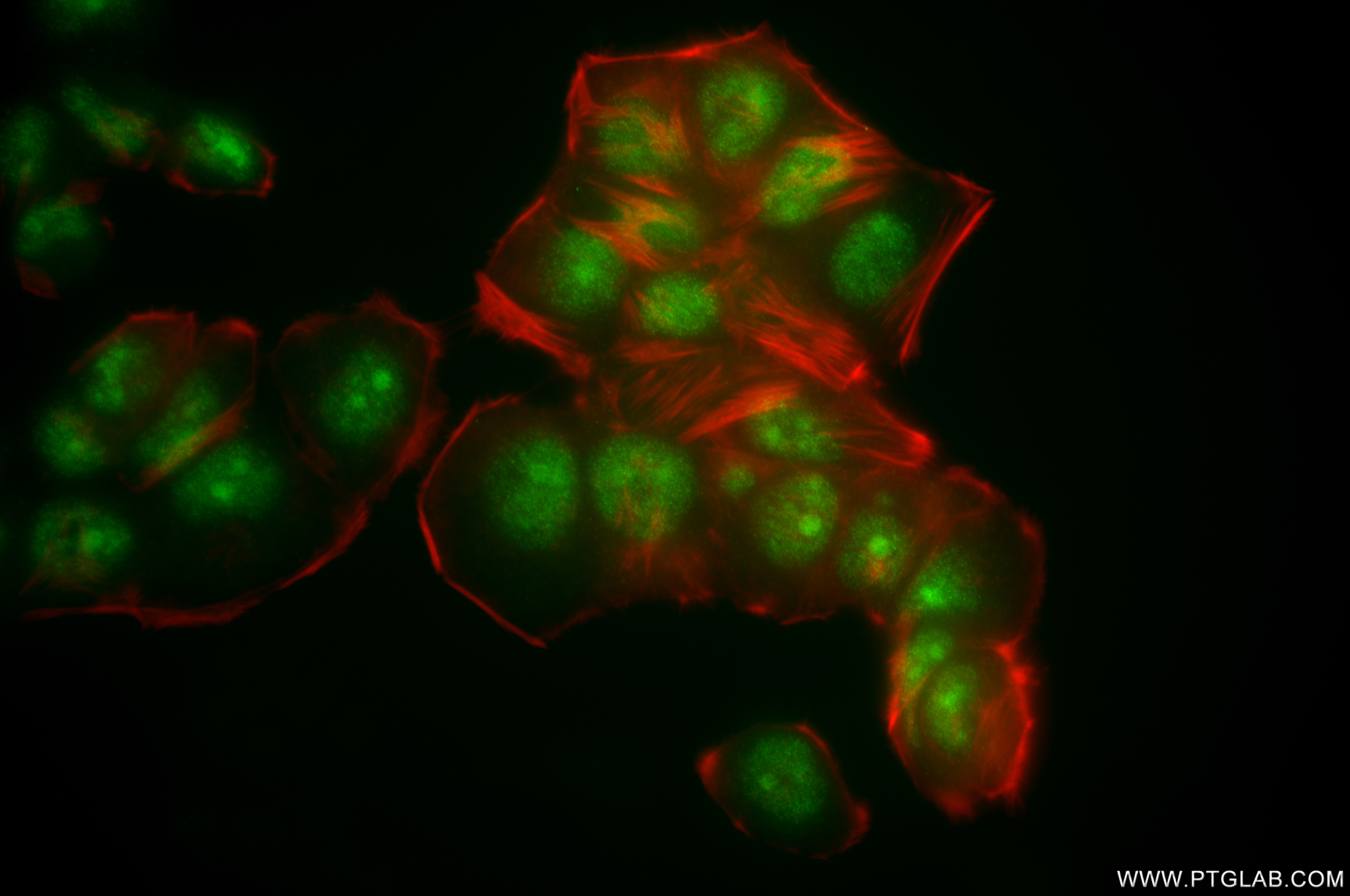 Immunofluorescence (IF) / fluorescent staining of NCCIT cells using Nanog Recombinant antibody (80210-13-RR)