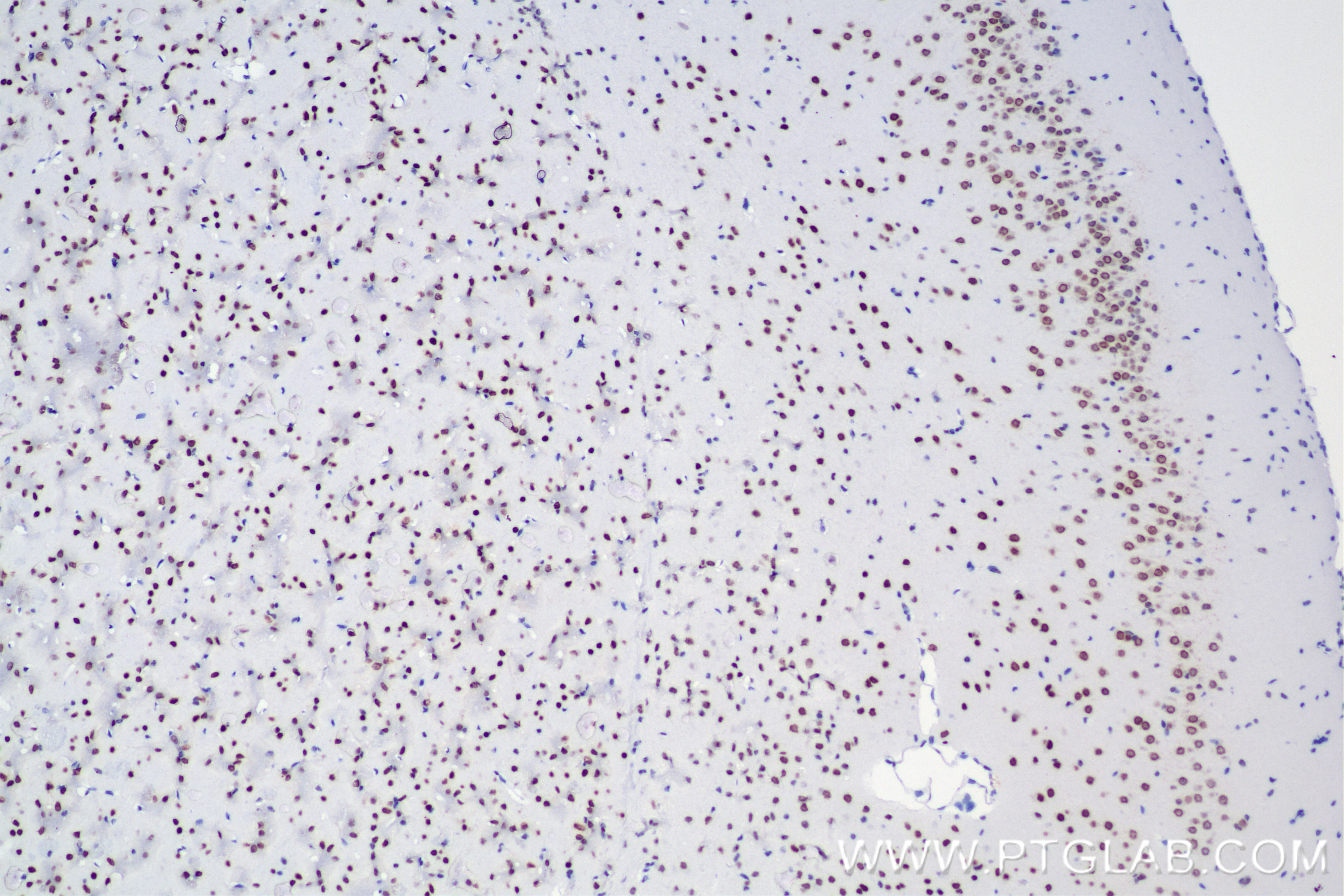 Immunohistochemistry (IHC) staining of mouse brain tissue using Nanog Recombinant antibody (80210-13-RR)