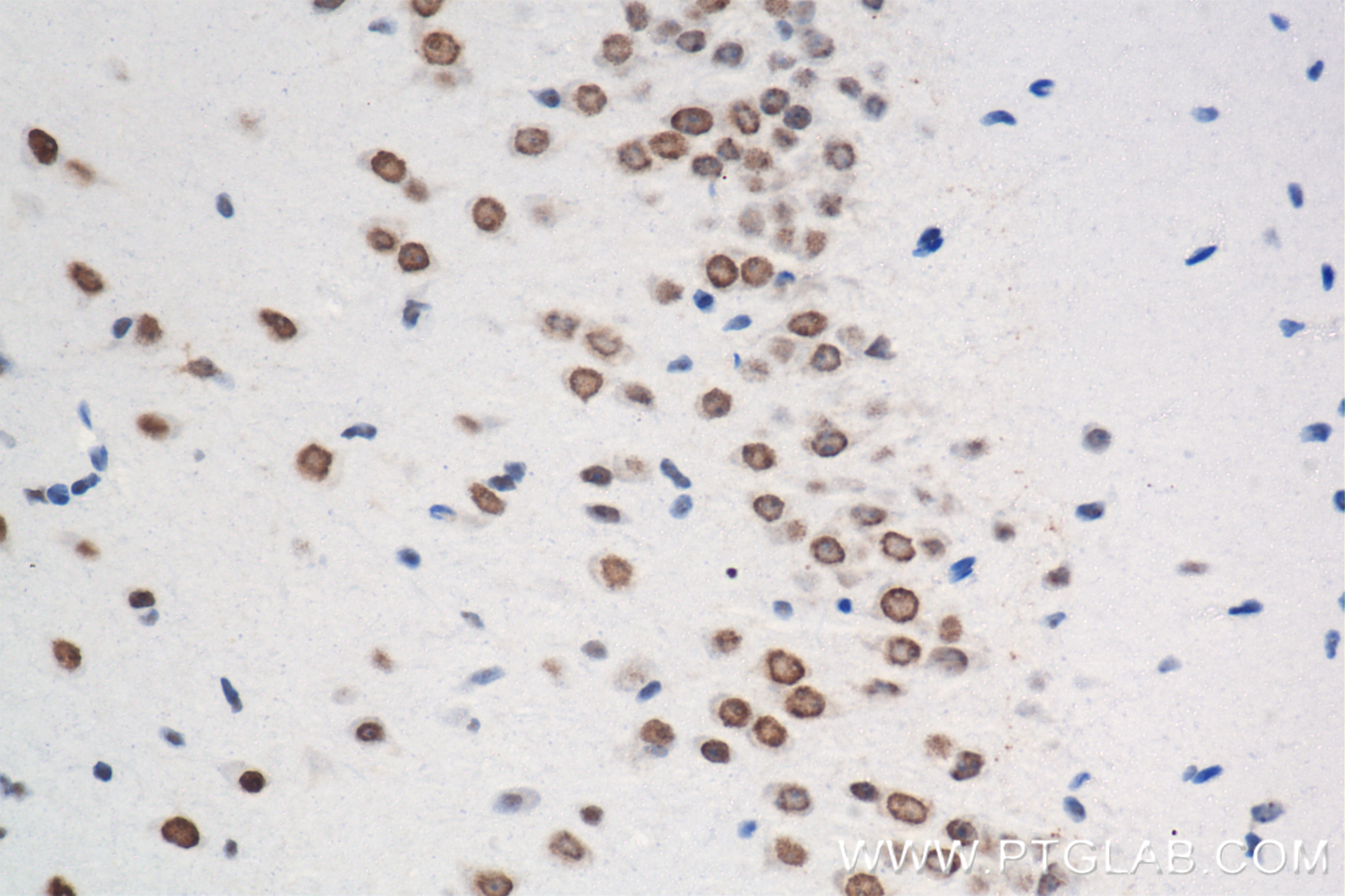 Immunohistochemistry (IHC) staining of mouse brain tissue using Nanog Recombinant antibody (80210-13-RR)