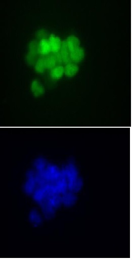 Nanog antibody (mAb) (Clone 2E6E1) tested by immunofluorescence. Top: HeLa cells stained with Nanog antibody (mAb). Bottom: Hoechst staining.