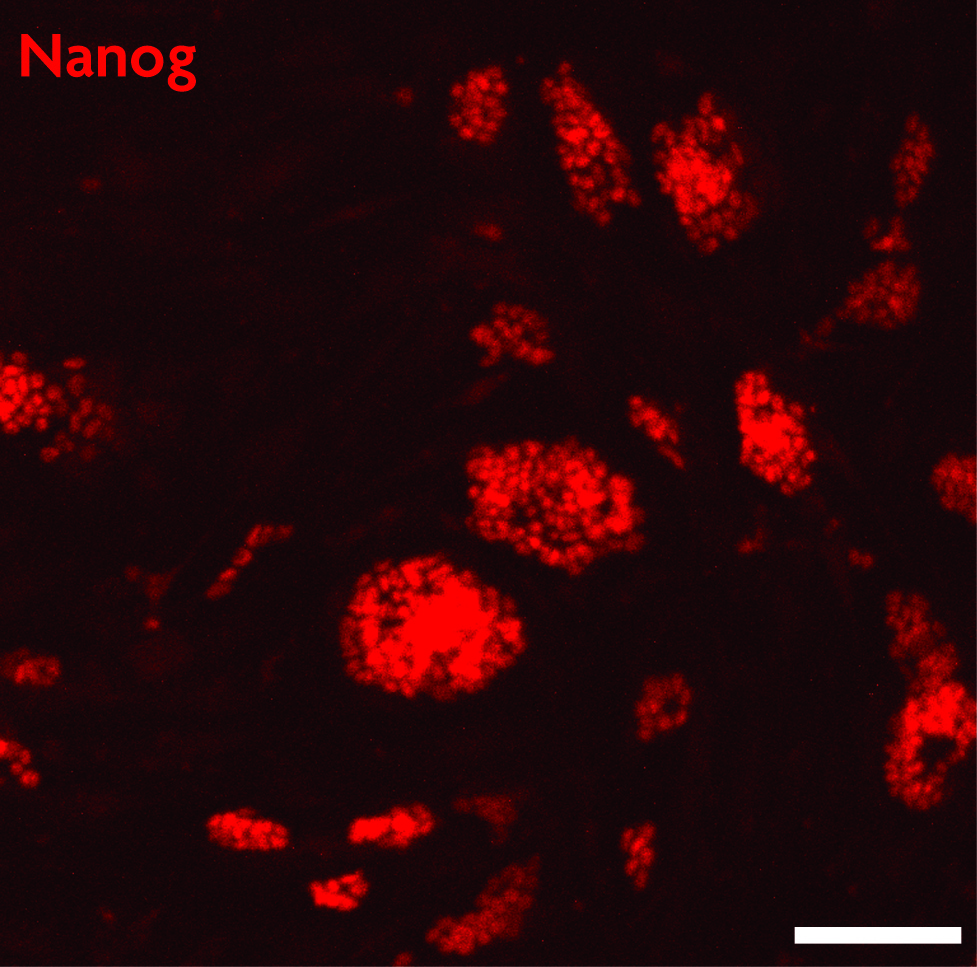 Nanog antibody (pAb) tested by Immunofluorescence Mouse embryonic stem cells (mESCs) grown on mouse embryonic fibroblast feeder cells (MEFs) were fixed with 4% paraformaldehyde for 10 minutes at room temperature. Cells were then permeabilized and blocked by incubating with Blocking Solution containing 5% serum/0.1% Triton X-100 in D-PBS for 2 hours at room temperature. Cells were then incubated with Nanog antibody (Catalog No. 61419, red) at 1:200 dilution overnight at 4°C, washed with D-PBS, and incubated for 2 hours at room temperature with goat anti-mouse Cy3 secondary antibody at 1:250 dilution. Cells were visualized using a Zeiss fluorescent microscope at 20X magnification. Images show that Nanog antibody specifically stains mESC colonies and does not stain MEFs. Absence of Nanog staining in a subset of cells within the colonies suggests differentiation. Scale bars, 100 μm.