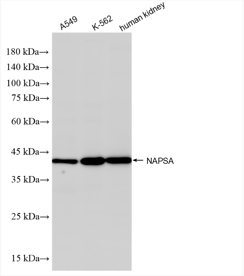 Western Blot (WB) analysis of various lysates using Napsin A Recombinant antibody (86052-1-RR)