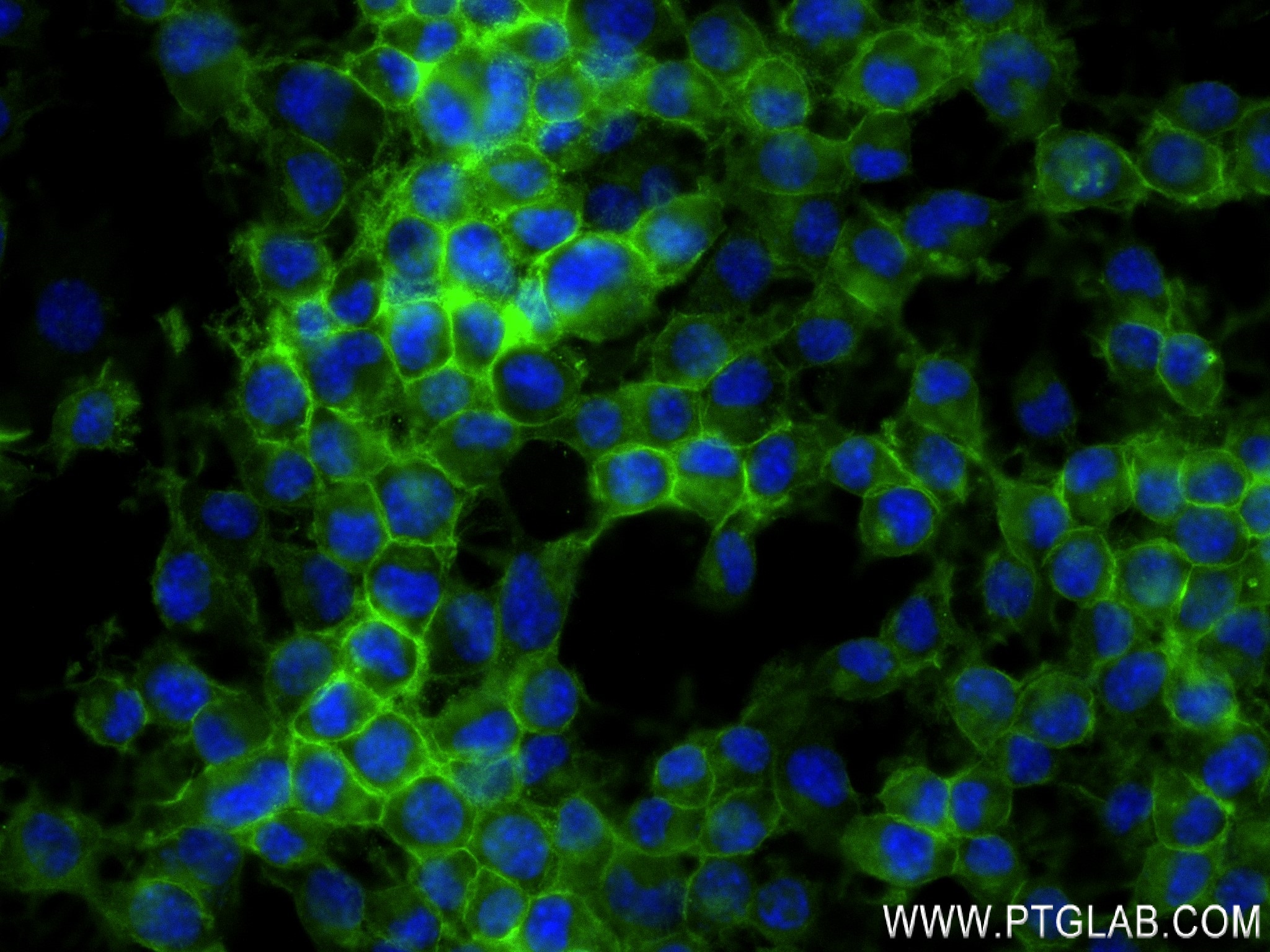 Immunofluorescence (IF) / fluorescent staining of Neuro-2a cells using Ncam1 Recombinant antibody (83883-5-RR)