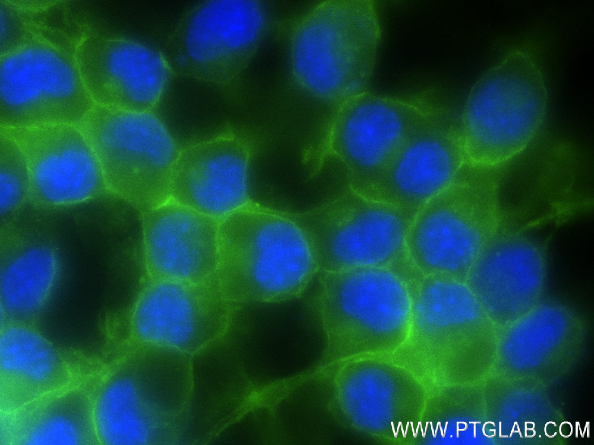 Immunofluorescence (IF) / fluorescent staining of Neuro-2a cells using Ncam1 Recombinant antibody (83883-5-RR)