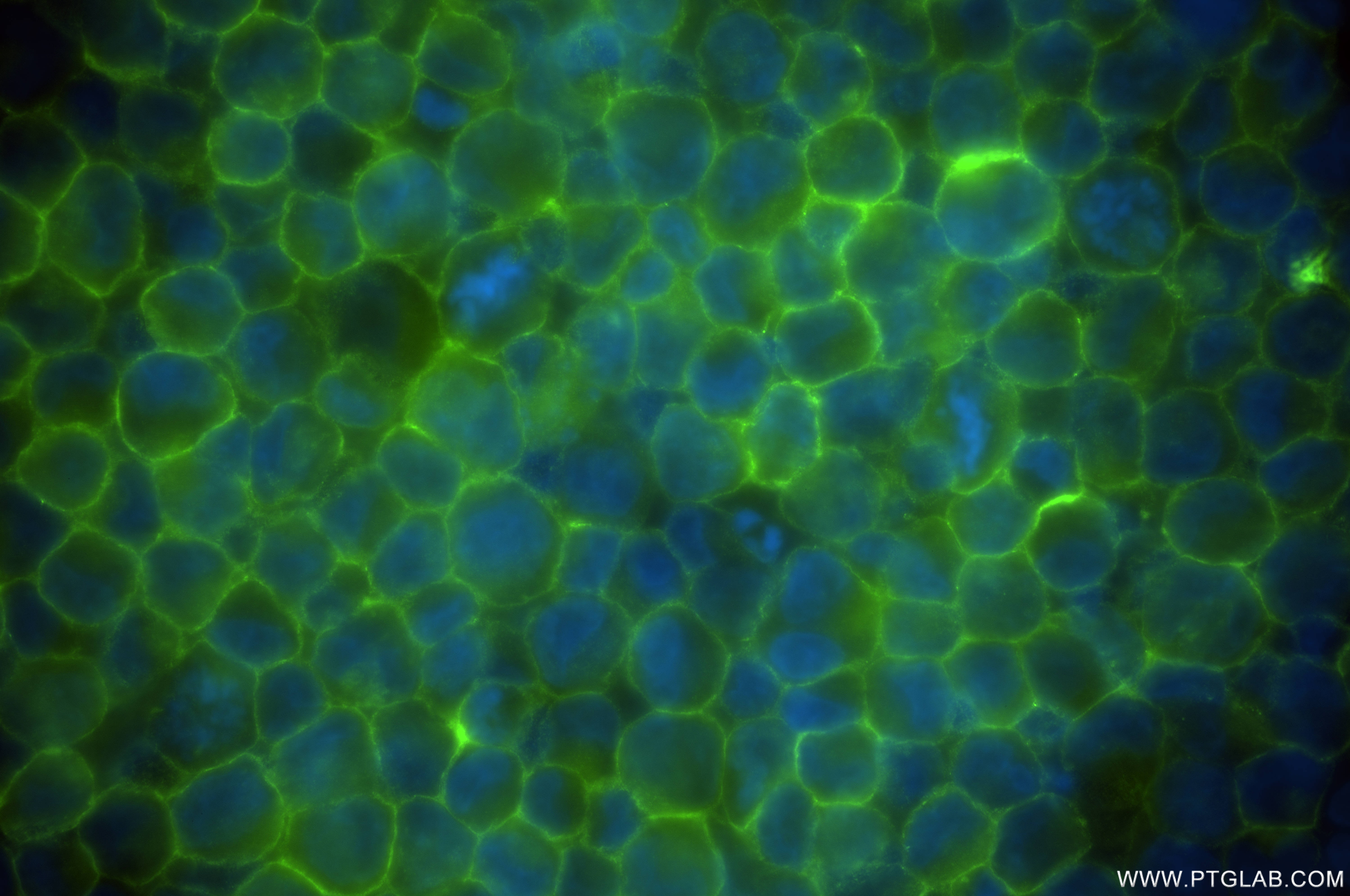 Immunofluorescence (IF) / fluorescent staining of K-562 cells using Nectin-2/CD112 Recombinant antibody (84460-5-RR)