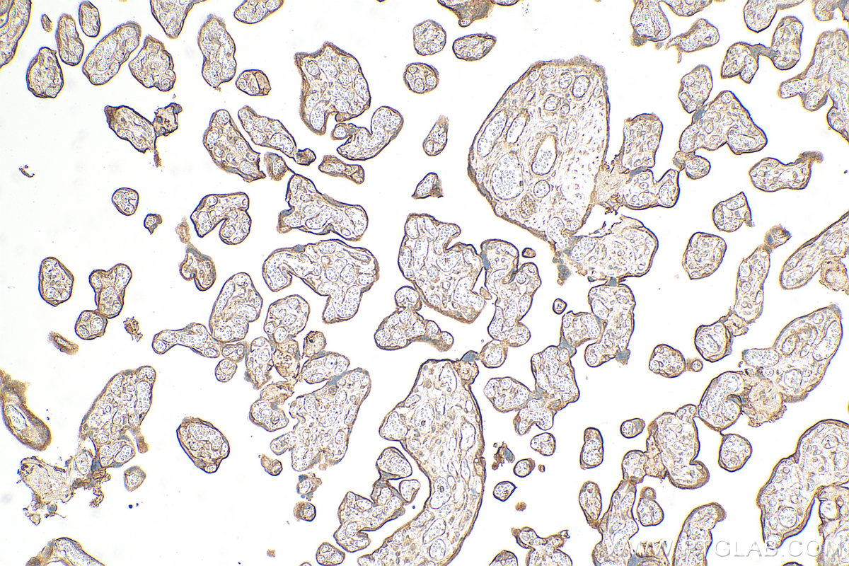 Immunohistochemistry (IHC) staining of human placenta tissue using Nectin-4/PVRL4 Polyclonal antibody (31026-1-AP)