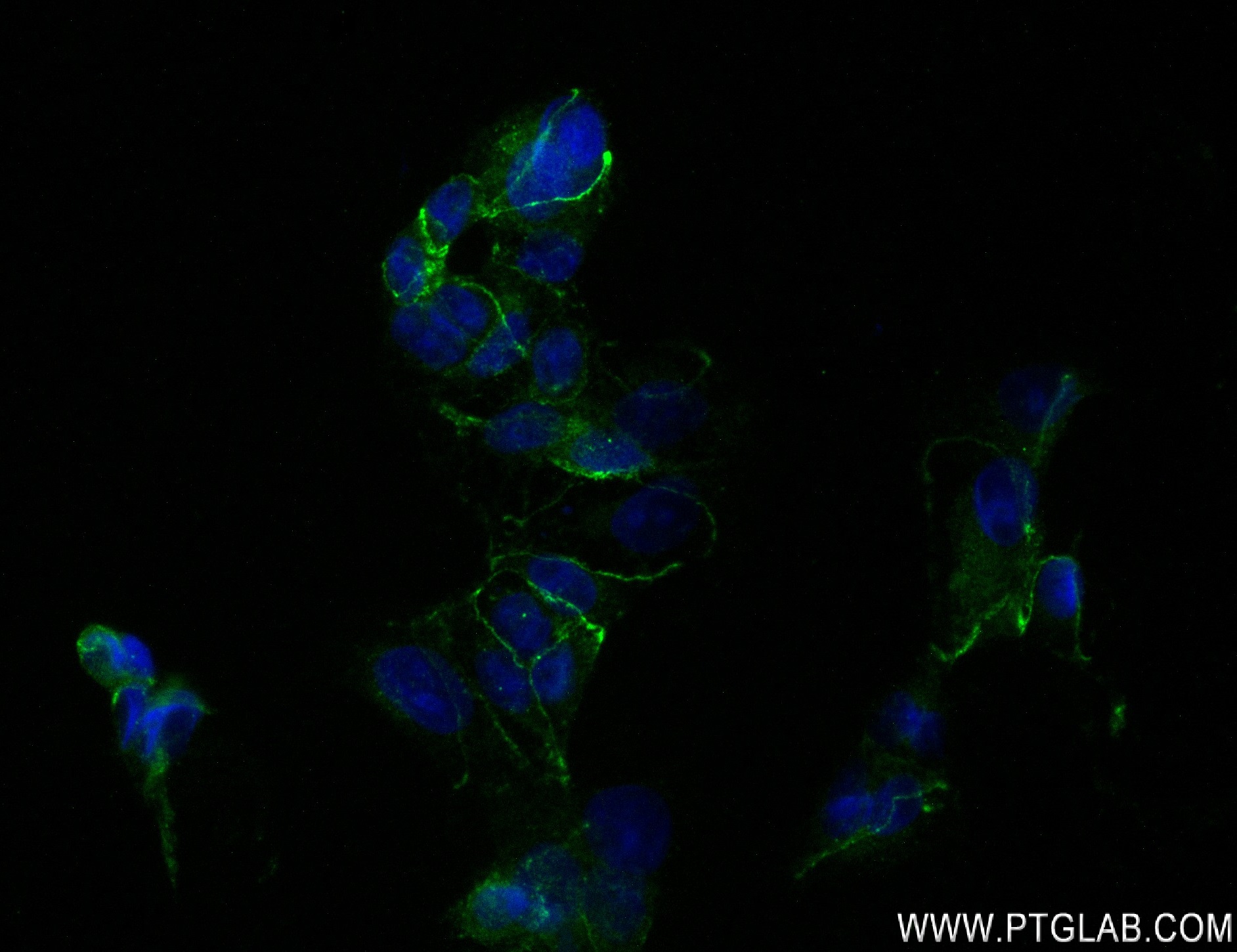 Immunofluorescence (IF) / fluorescent staining of MCF-7 cells using Nectin-4/PVRL4 Recombinant antibody (83223-4-RR)