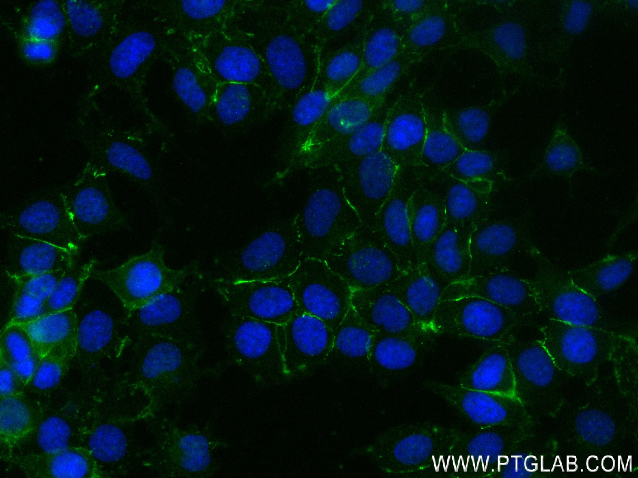 Immunofluorescence (IF) / fluorescent staining of MCF-7 cells using Nectin-4/PVRL4 Recombinant antibody (83223-4-RR)