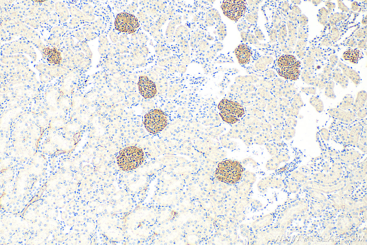 Immunohistochemistry (IHC) staining of rat kidney tissue using Nephrin Polyclonal antibody (22912-1-AP)