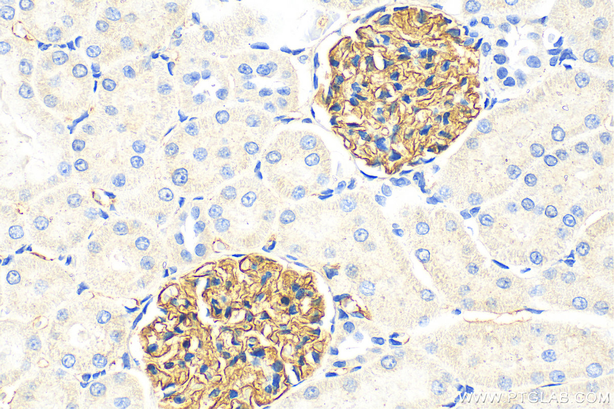 Immunohistochemistry (IHC) staining of rat kidney tissue using Nephrin Polyclonal antibody (22912-1-AP)