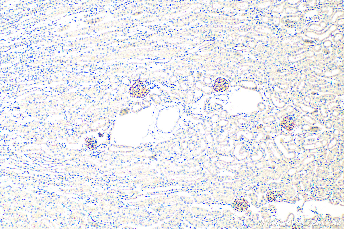 Immunohistochemistry (IHC) staining of mouse kidney tissue using Nephrin Polyclonal antibody (22912-1-AP)