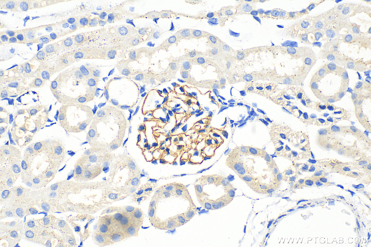 Immunohistochemistry (IHC) staining of mouse kidney tissue using Nephrin Polyclonal antibody (22912-1-AP)