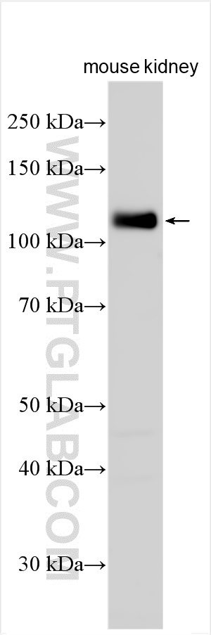 Western Blot (WB) analysis of various lysates using Nephrin Polyclonal antibody (22912-1-AP)