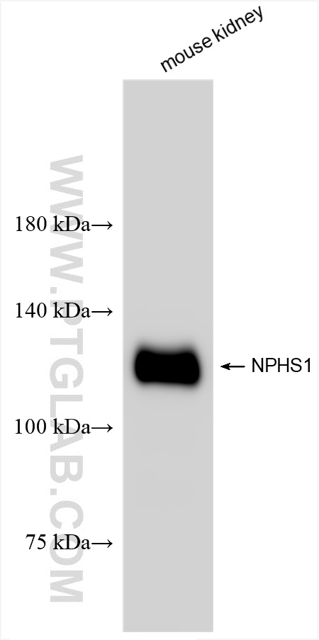 Western Blot (WB) analysis of mouse kidney tissue using Nephrin Recombinant antibody (85845-1-RR)