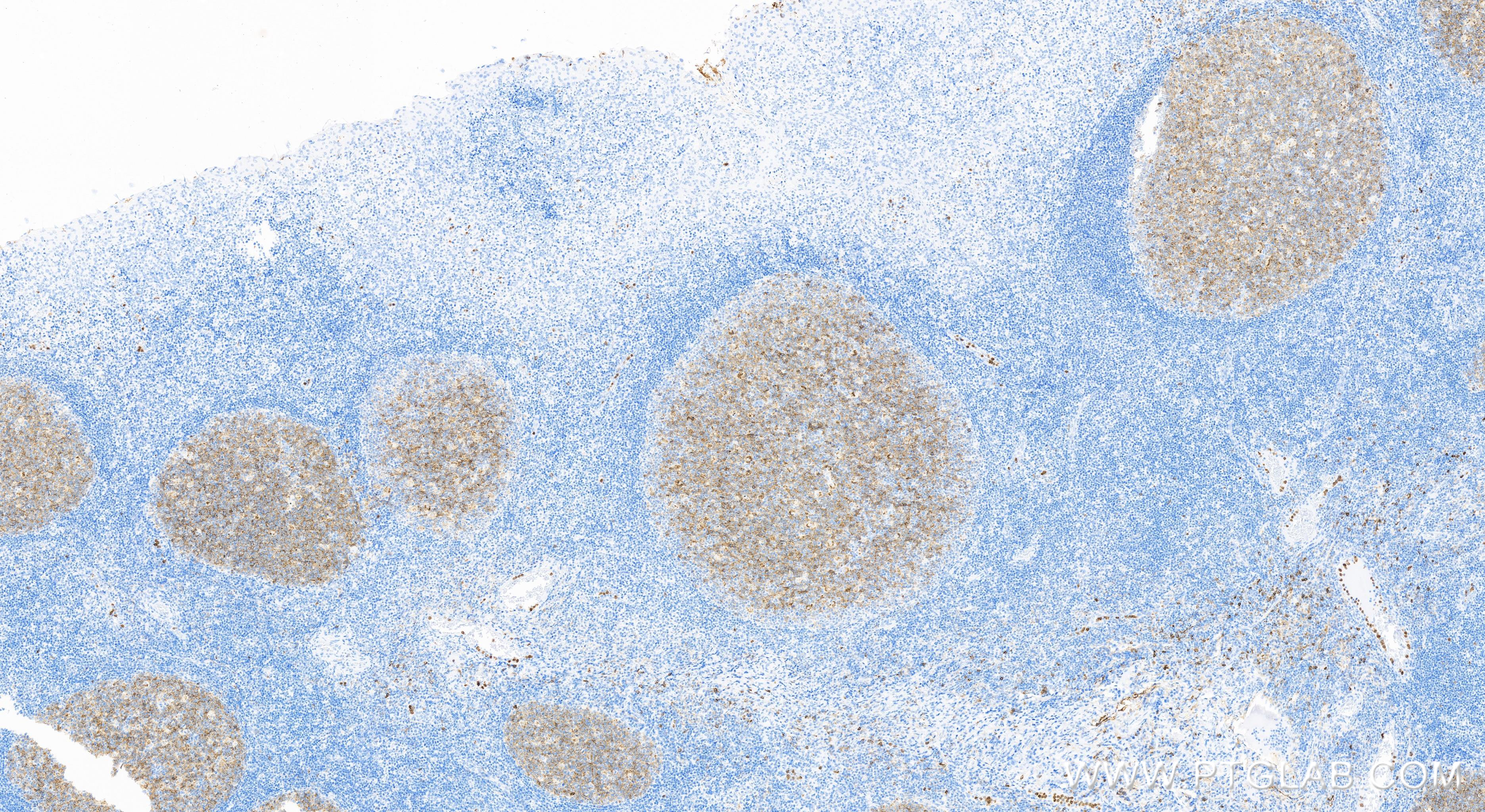 Immunohistochemistry (IHC) staining of human tonsillitis tissue using Neprilysin/CD10 Recombinant antibody (84181-1-RR)