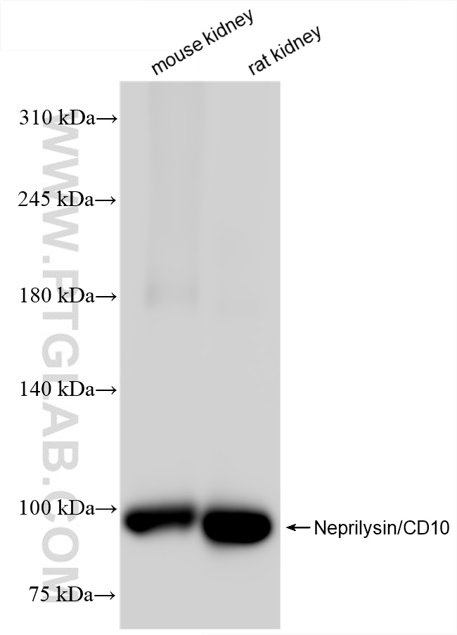 Western Blot (WB) analysis of various lysates using Neprilysin/CD10 Recombinant antibody (84181-1-RR)