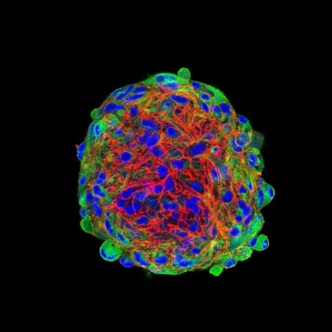 Immunofluorescence (IF) / fluorescent staining of human dental pulp-derived neuronal spheroid using CoraLite® Plus 488-conjugated Nestin Polyclonal an (CL488-19483)