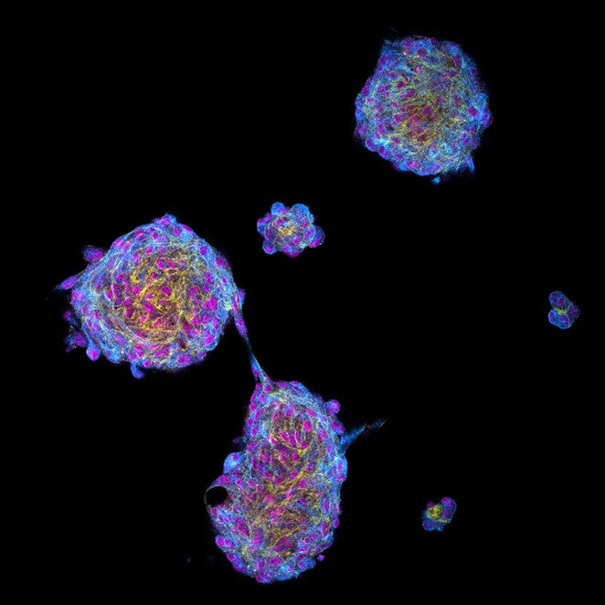 Immunofluorescence (IF) / fluorescent staining of human dental pulp-derived neuronal spheroids using CoraLite® Plus 488-conjugated Nestin Polyclonal an (CL488-19483)