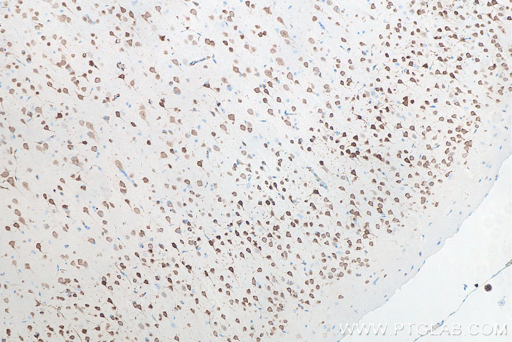 Immunohistochemistry (IHC) staining of rat brain tissue using NeuN Monoclonal antibody (66836-1-Ig)