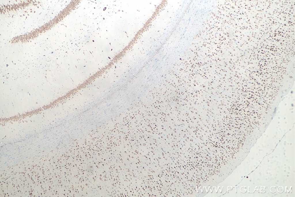 Immunohistochemistry (IHC) staining of rat brain tissue using NeuN Monoclonal antibody (66836-1-Ig)