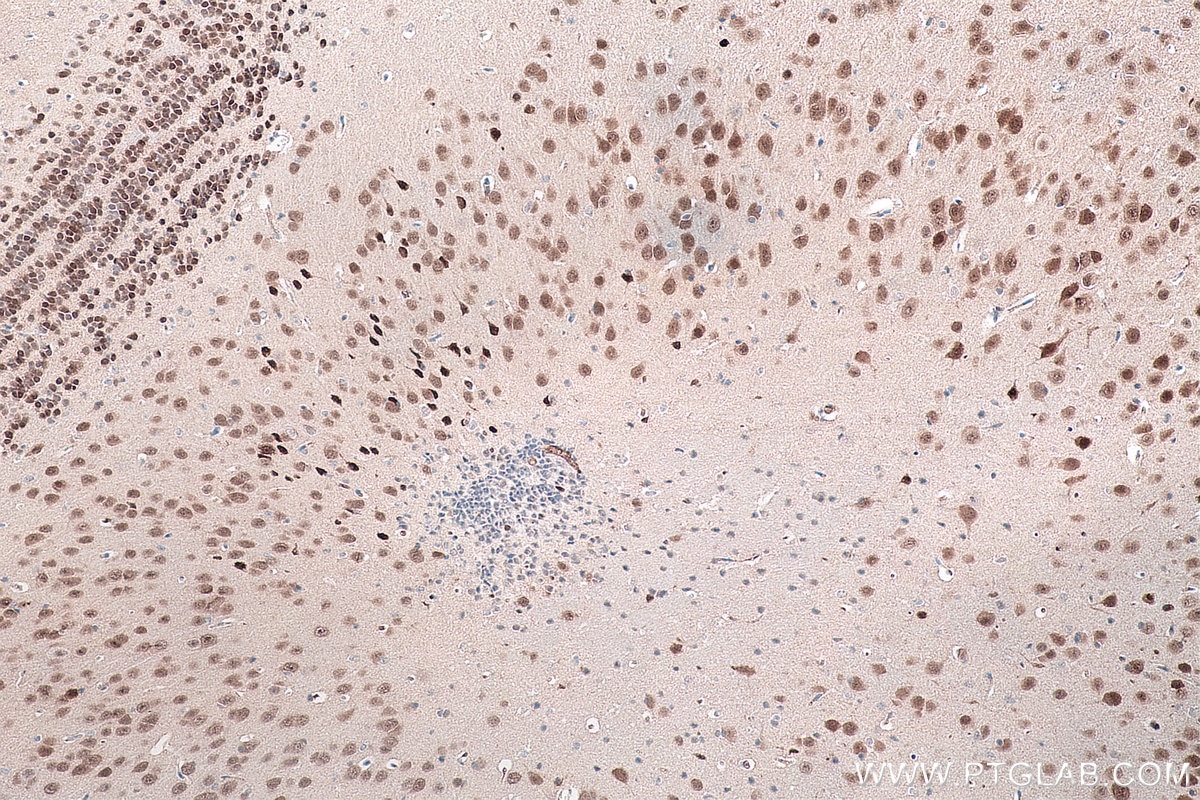 Immunohistochemistry (IHC) staining of mouse brain tissue using NeuN Monoclonal antibody (66836-1-Ig)