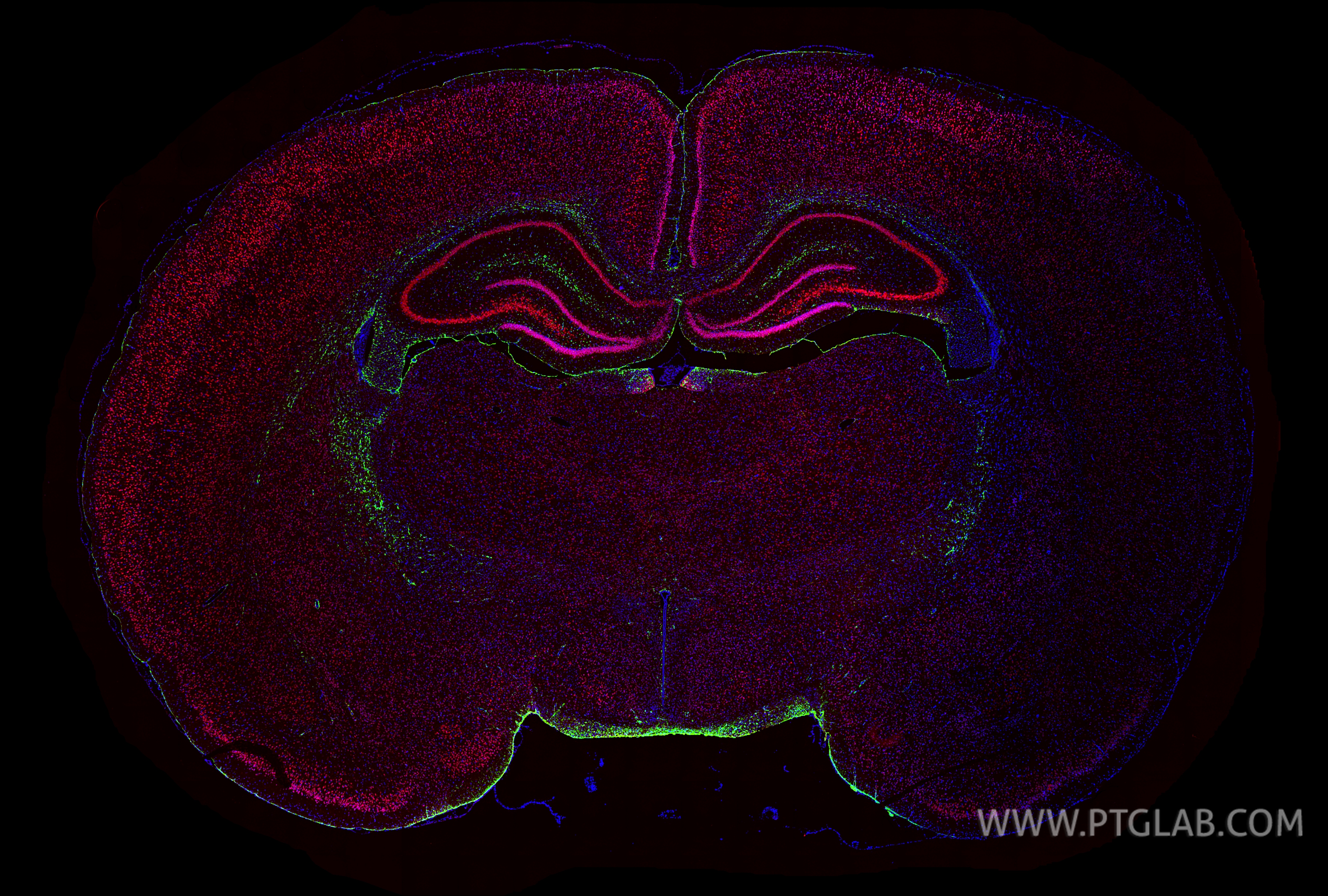 Immunofluorescence (IF) / fluorescent staining of rat brain tissue using CoraLite®594-conjugated NeuN Polyclonal antibody (CL594-26975)