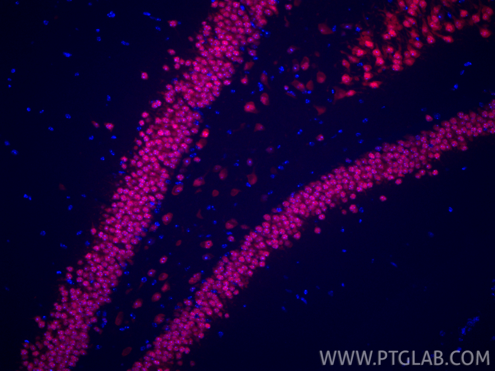 Immunofluorescence (IF) / fluorescent staining of mouse brain tissue using CoraLite®594-conjugated NeuN Recombinant antibody (CL594-84401-4)