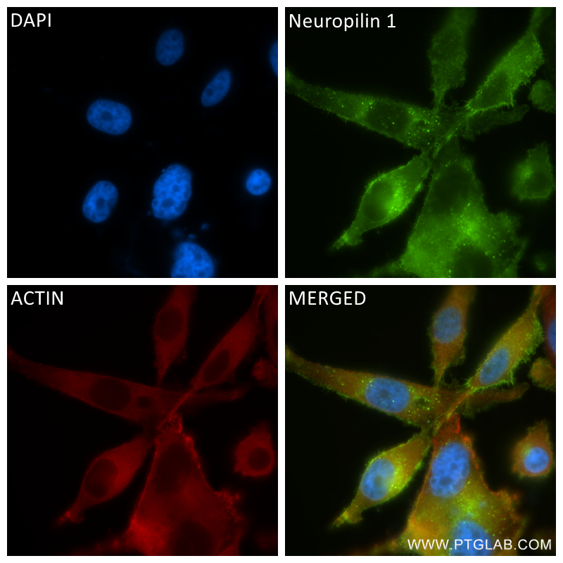 Immunofluorescence (IF) / fluorescent staining of PC-3 cells using Neuropilin 1 Recombinant antibody (84429-5-RR)