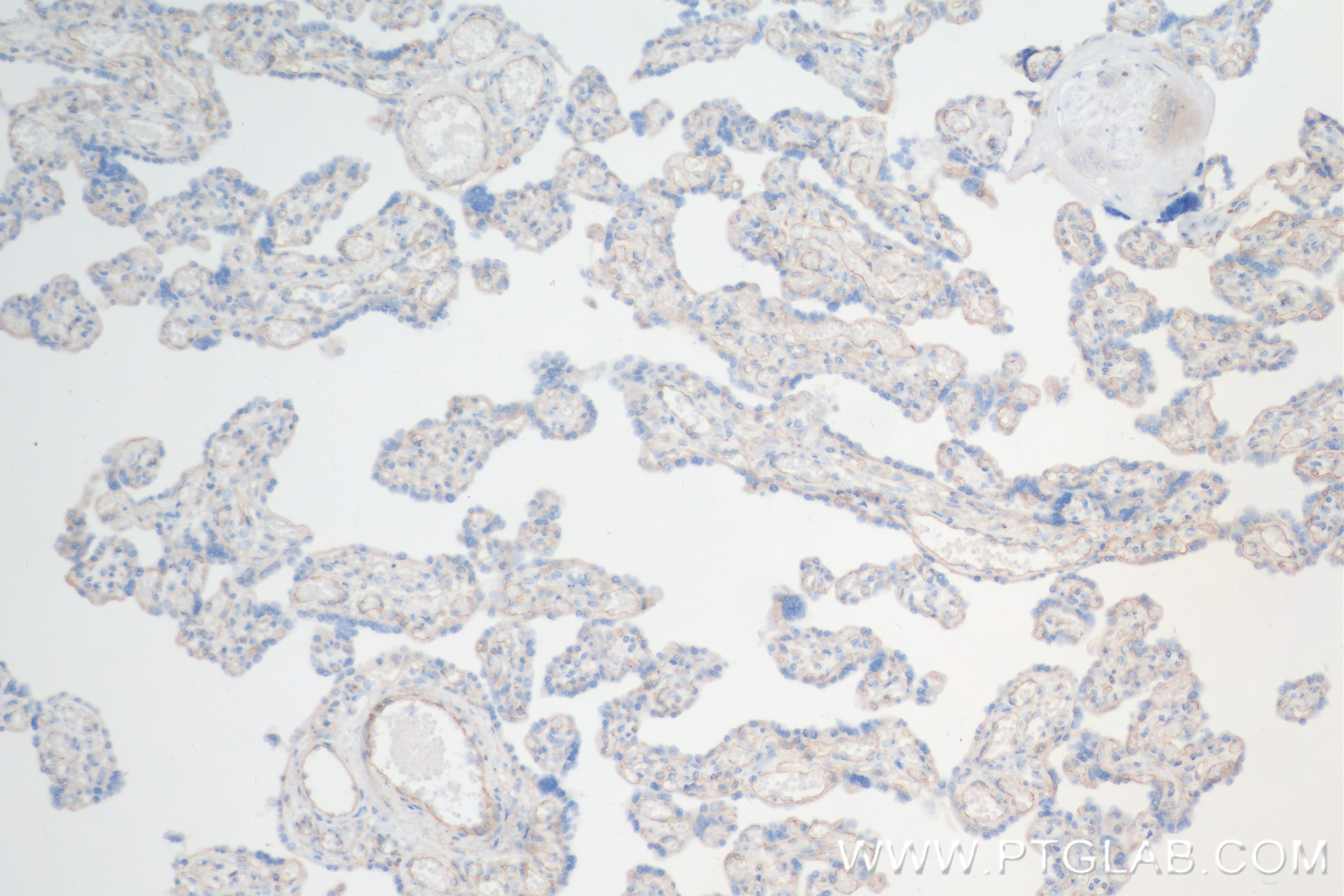 Immunohistochemistry (IHC) staining of human placenta tissue using Neuropilin 1 Recombinant antibody (84429-5-RR)