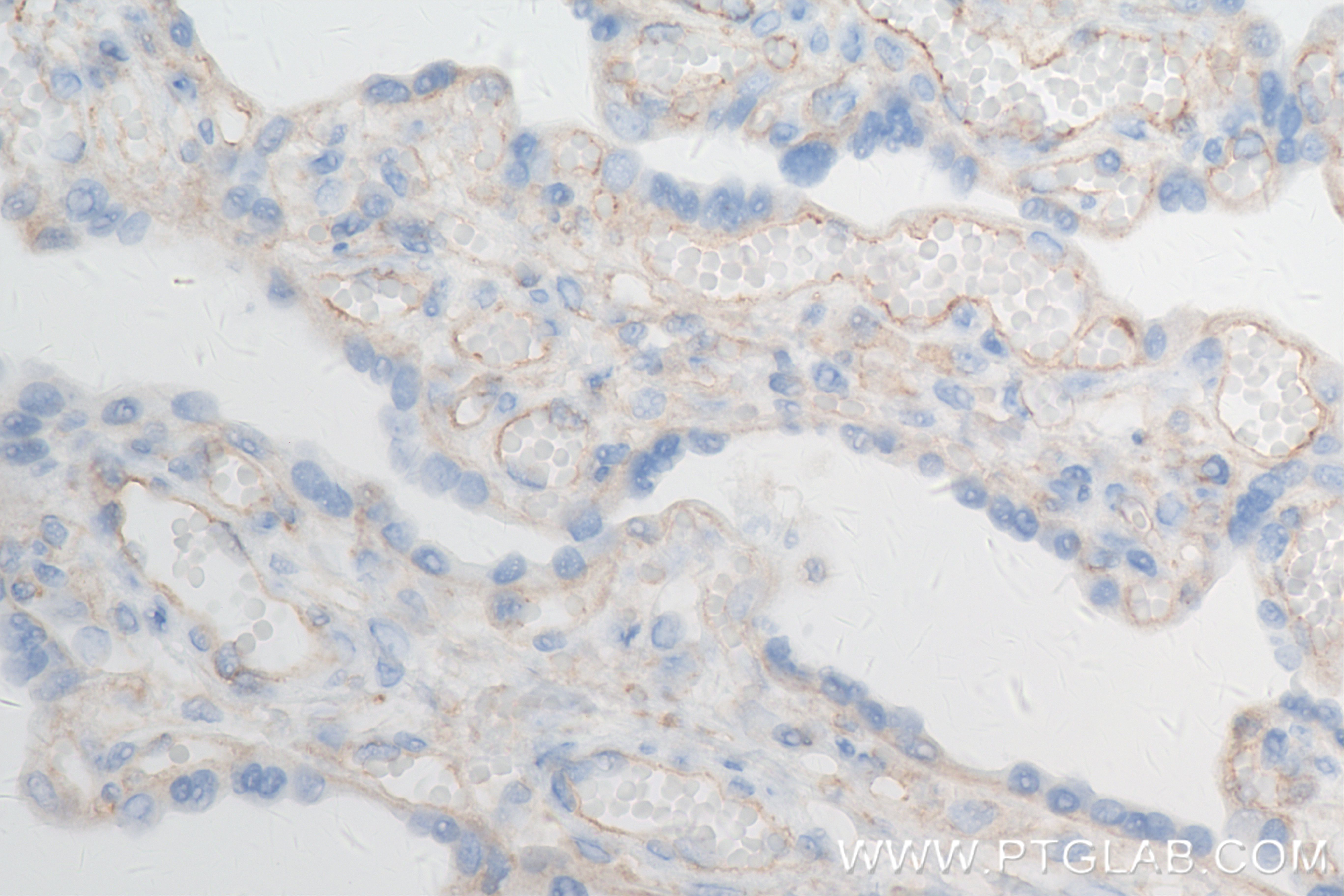 Immunohistochemistry (IHC) staining of human placenta tissue using Neuropilin 1 Recombinant antibody (84429-5-RR)