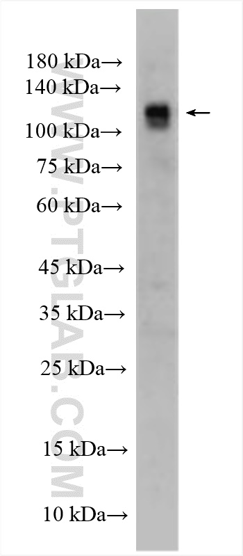 Western Blot (WB) analysis of U-87 MG cells using Neuropilin 2 Polyclonal antibody (27193-1-AP)