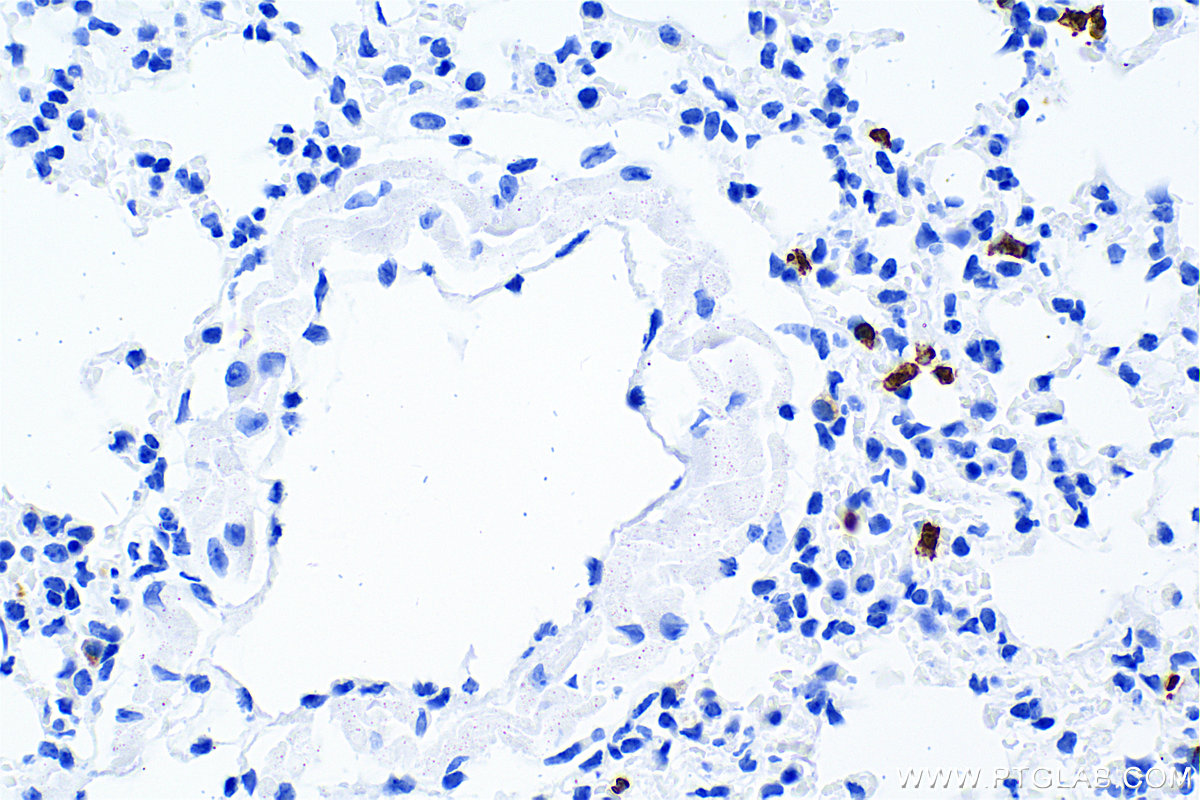 Immunohistochemistry (IHC) staining of mouse lung tissue using Lipocalin-2/Ngal Recombinant antibody (83102-1-RR)