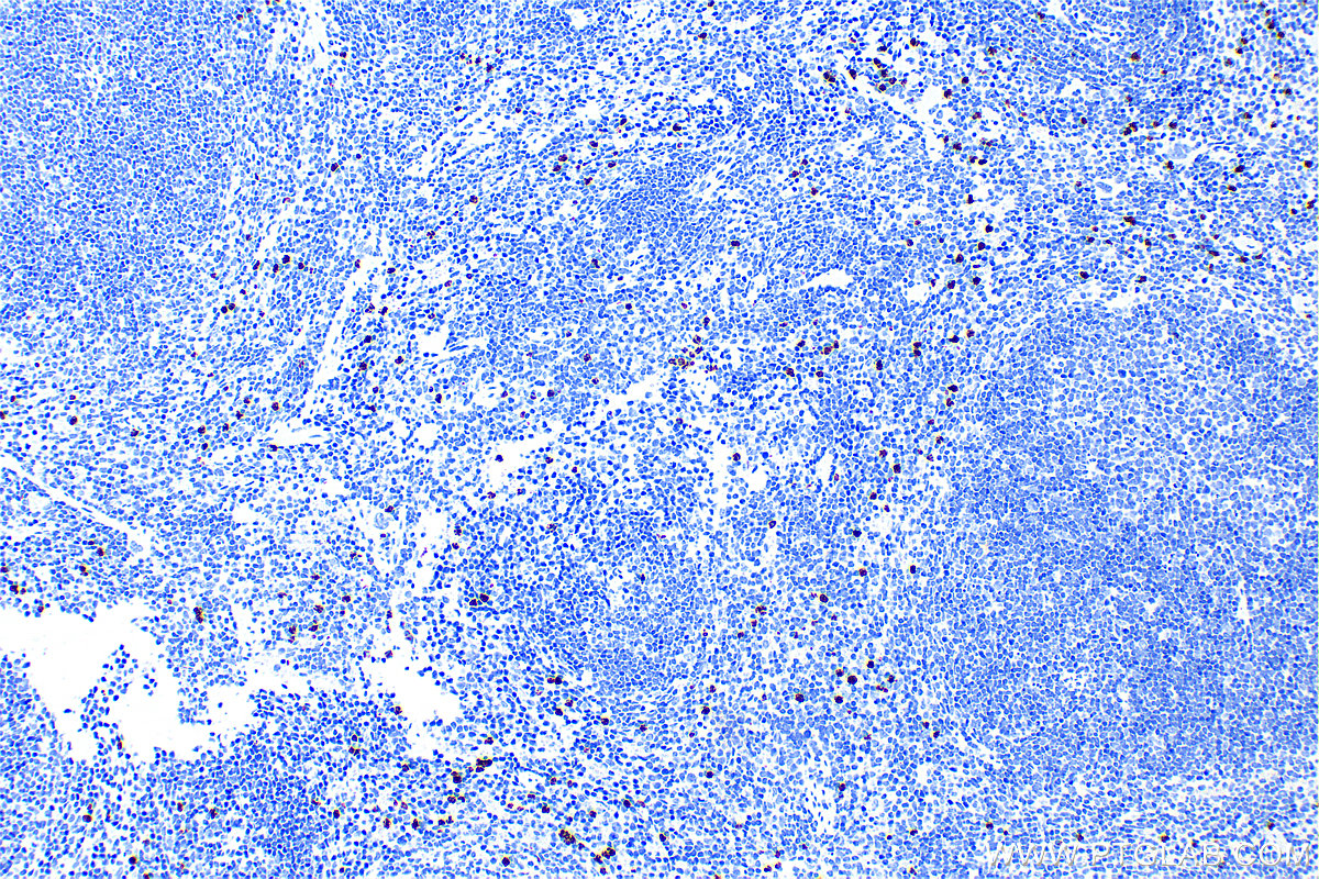 Immunohistochemistry (IHC) staining of mouse spleen tissue using Lipocalin-2/Ngal Recombinant antibody (83102-1-RR)