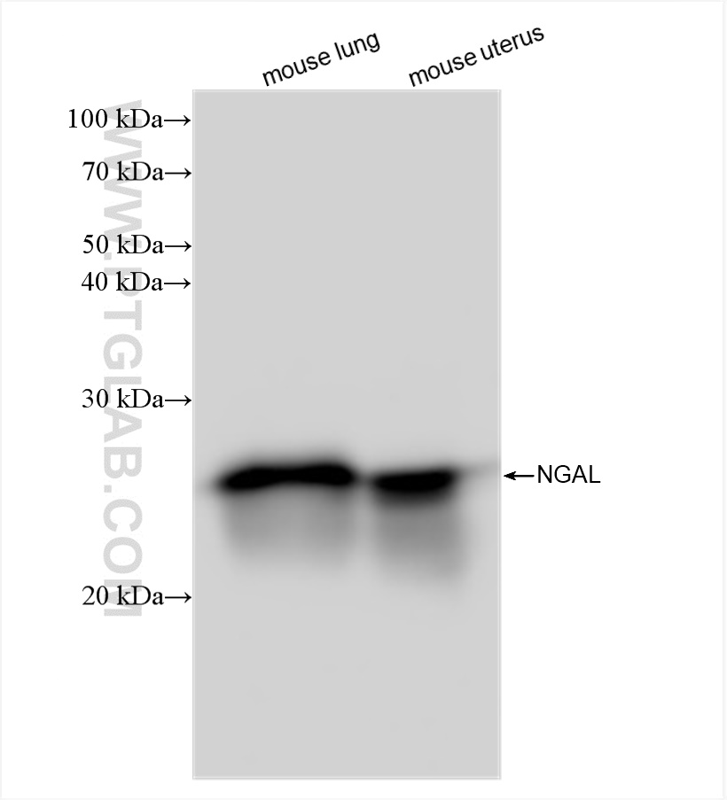 Western Blot (WB) analysis of various lysates using Lipocalin-2/Ngal Recombinant antibody (83102-1-RR)